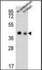 TPC antibody, orb178982, Biorbyt, Western Blot image 