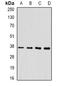 Melanocyte protein PMEL antibody, orb388648, Biorbyt, Western Blot image 