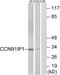 Cyclin B1 Interacting Protein 1 antibody, A30659, Boster Biological Technology, Western Blot image 