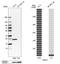Peroxiredoxin 1 antibody, HPA007730, Atlas Antibodies, Western Blot image 