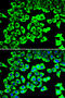 Ribosomal Protein Lateral Stalk Subunit P2 antibody, abx005289, Abbexa, Western Blot image 