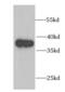 FPS antibody, FNab03065, FineTest, Western Blot image 