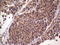 Ret Proto-Oncogene antibody, LS-C798268, Lifespan Biosciences, Immunohistochemistry paraffin image 
