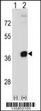 Phosphoribosyl Pyrophosphate Synthetase 2 antibody, 58-473, ProSci, Western Blot image 