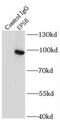 Epidermal Growth Factor Receptor Pathway Substrate 8 antibody, FNab02819, FineTest, Immunoprecipitation image 