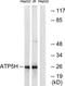 ATP Synthase Peripheral Stalk Subunit D antibody, TA315059, Origene, Western Blot image 