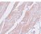 Coiled-Coil Domain Containing 47 antibody, A12188, Boster Biological Technology, Immunohistochemistry paraffin image 