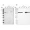 Acyl-CoA Dehydrogenase Very Long Chain antibody, NBP1-89286, Novus Biologicals, Western Blot image 