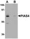 Protein Inhibitor Of Activated STAT 4 antibody, orb75420, Biorbyt, Western Blot image 