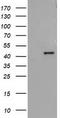 Alcohol Dehydrogenase 1B (Class I), Beta Polypeptide antibody, CF502778, Origene, Western Blot image 