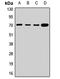 Proton myo-inositol cotransporter antibody, LS-C668915, Lifespan Biosciences, Western Blot image 