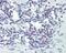 Phospholipase C Gamma 1 antibody, 49-843, ProSci, Immunohistochemistry paraffin image 