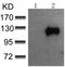 Cbl Proto-Oncogene antibody, TA321686, Origene, Western Blot image 