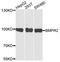Bone Morphogenetic Protein Receptor Type 2 antibody, A5666, ABclonal Technology, Western Blot image 