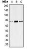 Potassium Voltage-Gated Channel Subfamily Q Member 4 antibody, orb214864, Biorbyt, Western Blot image 