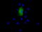 Epoxide Hydrolase 2 antibody, TA501599, Origene, Immunofluorescence image 