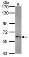 Myotubularin Related Protein 9 antibody, TA308103, Origene, Western Blot image 