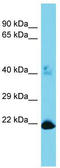 Methyltransferase Like 26 antibody, TA333614, Origene, Western Blot image 