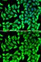 Vesicle Transport Through Interaction With T-SNAREs 1B antibody, GTX32969, GeneTex, Immunofluorescence image 