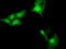 NSE2 (MMS21) Homolog, SMC5-SMC6 Complex SUMO Ligase antibody, TA501632, Origene, Immunofluorescence image 