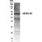 endogenous Retrovirus antibody, PA1-23360, Invitrogen Antibodies, Western Blot image 