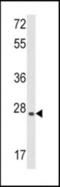 Calcium Dependent Secretion Activator antibody, orb74975, Biorbyt, Western Blot image 