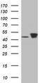Tubulin Beta 2B Class IIb antibody, TA506603S, Origene, Western Blot image 