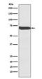 Frizzled Class Receptor 9 antibody, M08165, Boster Biological Technology, Western Blot image 