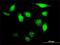 Uridine-Cytidine Kinase 1 Like 1 antibody, H00054963-M01, Novus Biologicals, Immunocytochemistry image 