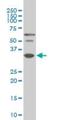 Paired box protein Pax-9 antibody, H00005083-M03, Novus Biologicals, Western Blot image 