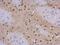 COP9 Signalosome Subunit 8 antibody, PA5-78348, Invitrogen Antibodies, Immunohistochemistry frozen image 