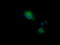 Cancer/Testis Antigen 1B antibody, LS-C797700, Lifespan Biosciences, Immunofluorescence image 