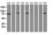 Catenin Beta 1 antibody, LS-C337243, Lifespan Biosciences, Western Blot image 