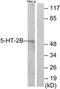 5-Hydroxytryptamine Receptor 2B antibody, TA314042, Origene, Western Blot image 