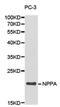 Natriuretic Peptide A antibody, PA5-76052, Invitrogen Antibodies, Western Blot image 
