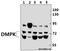 DM1 Protein Kinase antibody, A00797-1, Boster Biological Technology, Western Blot image 