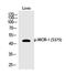 Mu-type opioid receptor antibody, PA5-40291, Invitrogen Antibodies, Western Blot image 