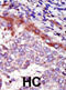 Hormonally Up-Regulated Neu-Associated Kinase antibody, abx033787, Abbexa, Immunohistochemistry paraffin image 