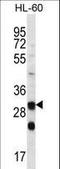 Carbonic anhydrase 6 antibody, LS-C168244, Lifespan Biosciences, Western Blot image 