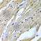 Tumor Suppressor 2, Mitochondrial Calcium Regulator antibody, A7075, ABclonal Technology, Immunohistochemistry paraffin image 