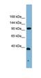 ERCC Excision Repair 4, Endonuclease Catalytic Subunit antibody, orb330965, Biorbyt, Western Blot image 