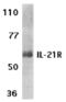 Interleukin 21 Receptor antibody, TA306078, Origene, Western Blot image 