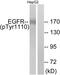 EGFR antibody, TA312539, Origene, Western Blot image 