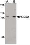 Family With Sequence Similarity 120B antibody, PA5-20801, Invitrogen Antibodies, Western Blot image 