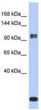 Ataxin-7 antibody, TA334172, Origene, Western Blot image 