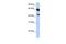 Abhydrolase Domain Containing 16A antibody, GTX46029, GeneTex, Western Blot image 