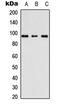 A-Kinase Anchoring Protein 3 antibody, LS-C354517, Lifespan Biosciences, Western Blot image 