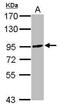 Short transient receptor potential channel 6 antibody, PA5-29847, Invitrogen Antibodies, Western Blot image 