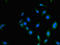 Proteasome 26S Subunit, Non-ATPase 2 antibody, orb29432, Biorbyt, Immunocytochemistry image 
