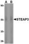 STEAP3 Metalloreductase antibody, TA306465, Origene, Western Blot image 